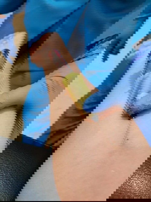 Ambil darah untuk cek NIPT