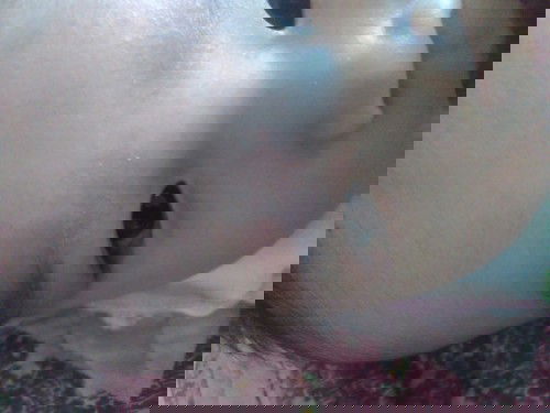 Bé nhà em bị sốt xong bị nổi cái này lên là như nào ạ ?