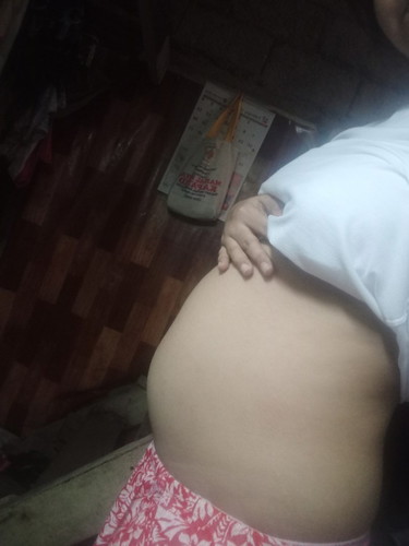 Baby bump.
