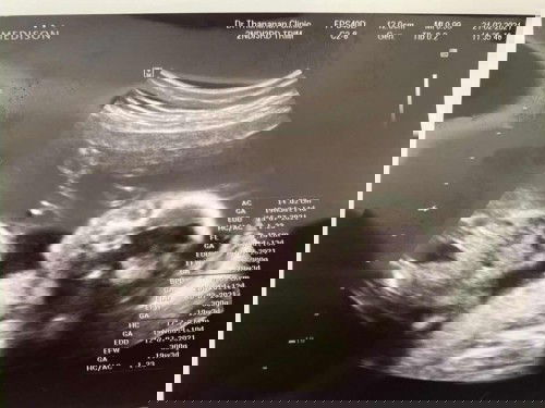 ลูกชาย 20 week