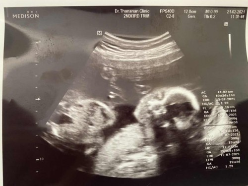 ลูกชาย 20 week