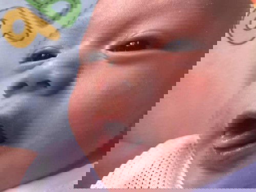 น้องเป็นกลากน้ำนมใช่ไหมคะ ทายาอะไรจะหาย