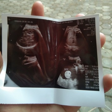 Sejak berapa minggu kepala janin yang harus masuk panggul