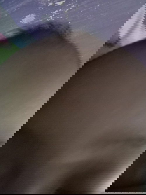 Ubun-ubun baby menonjol