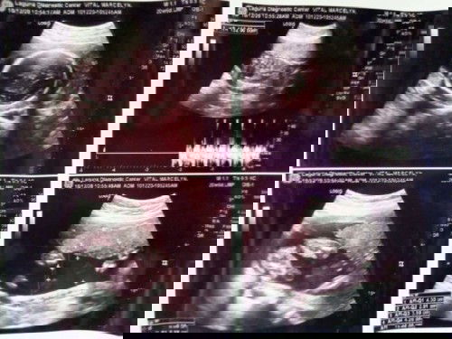 It's a BABY GIRL!!!!!!!!!!!!!!! 💖🎊
ANNA MAXINE A. VITAL 😍😘🥰