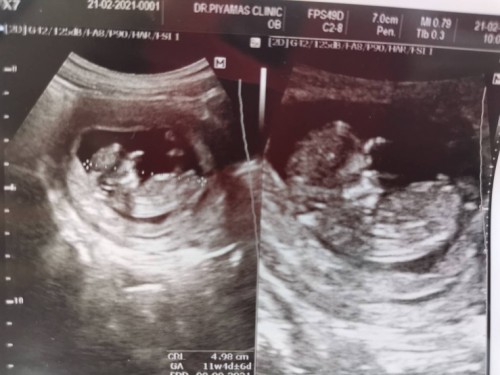 เจ้าตัวเล็ก 11w5d