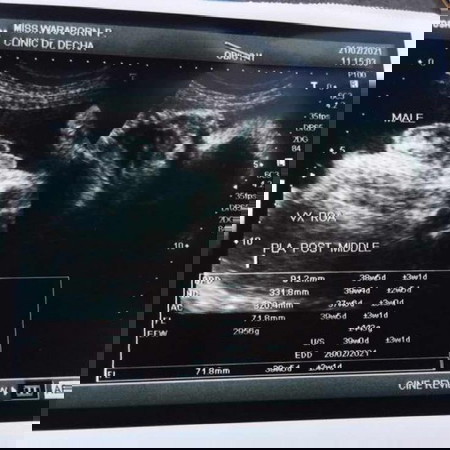 กลับหัวแร้วนะค่ะ ตื่นเต้นจัง 38 วีคแร้วค่ะ น้ำหนัก2956 🥰👶🏻