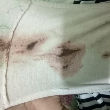 Spotting or Bleeding