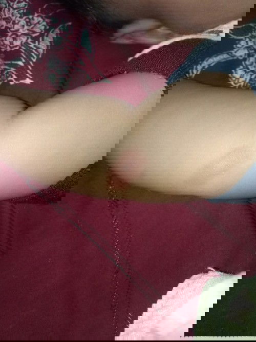 Bentol merah pada tangan bayi