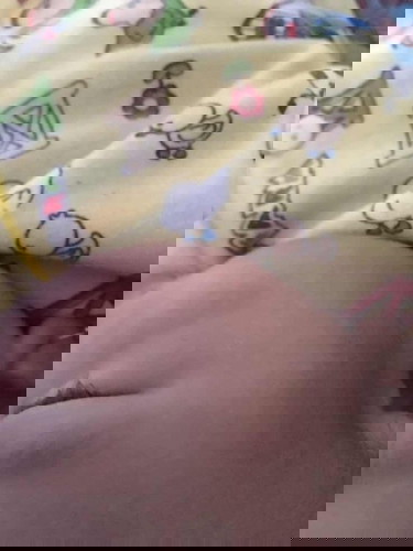 Bintik putih pipi bayi