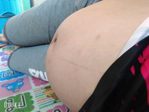 38 วีค 3 วันแร้ว เมื่อจะออก รอยุนะคาบลูกชาย 🥰👶🏻