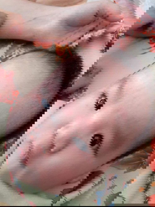 Các mom cho em hỏi là bé nhà em bị như này xong ngứa nữa là bị ls ạ