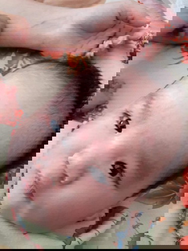 Các mom cho em hỏi là bé nhà em bị như này xong ngứa nữa là bị ls ạ