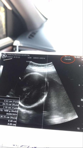 การสังเกตเพศลูก