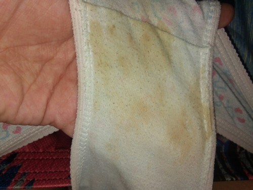 Blood or Normal Discharge? Pahelp po sana may makapansin..