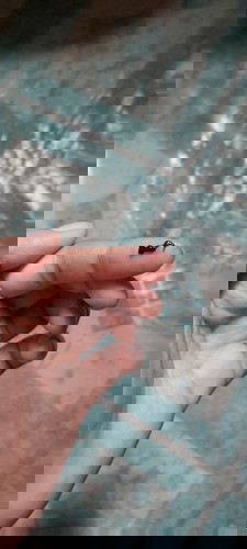 Blood clot after sex