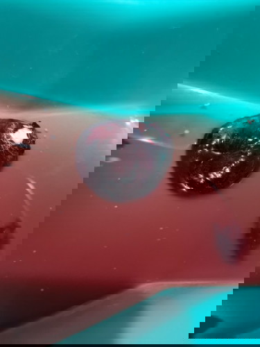 Viginal bleeding, healthy baby