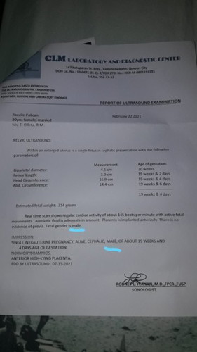 High fetal heart rate