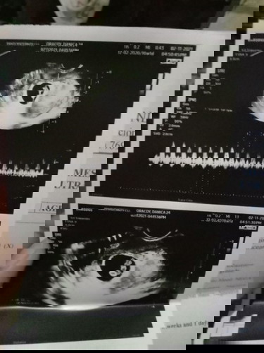 First time Mom🥰🥰