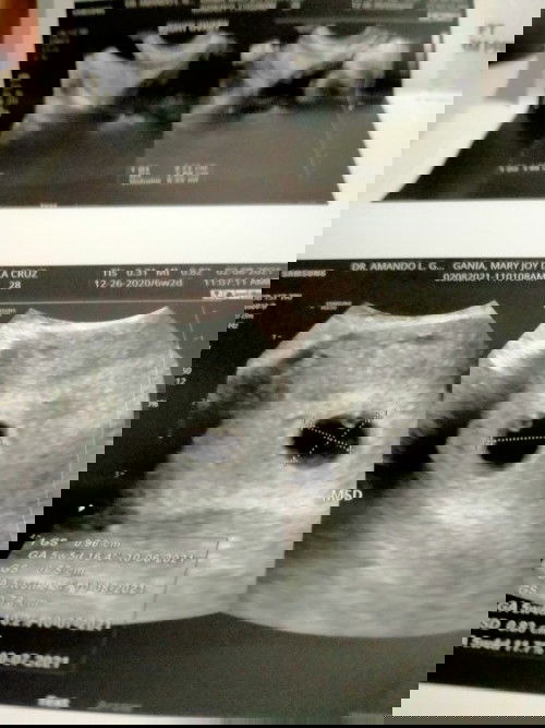 Heartbroken failed pregnancy