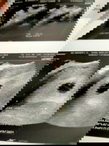 Heartbroken failed pregnancy