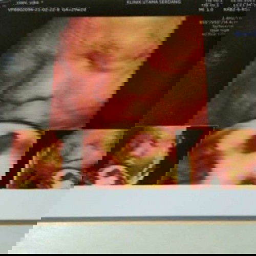 Hasil USG kehamilan ku