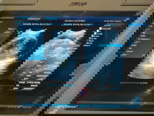 Bertanya tentang HPL