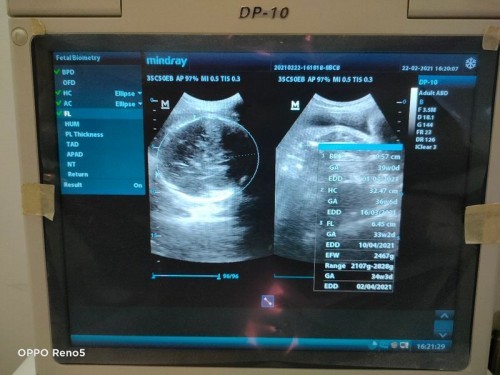 Bertanya tentang HPL