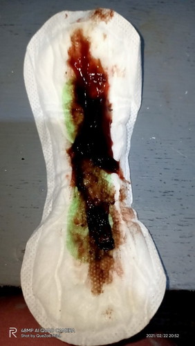 STICKY Blood Discharge