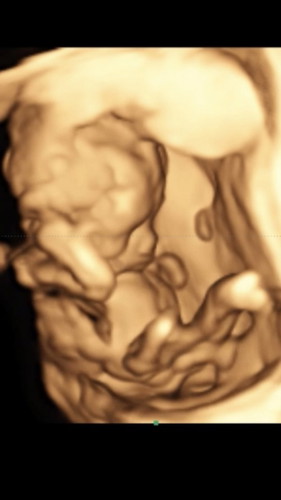 17week 3 day ทีมกรกฎา