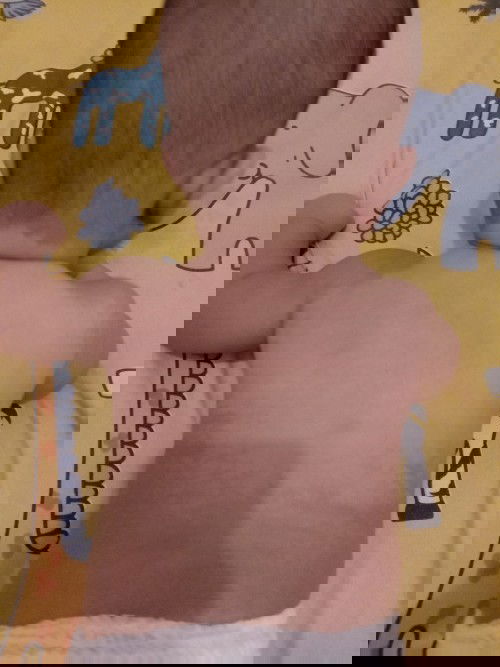 Warna kulit flek putih