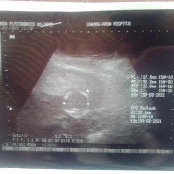 ซาวด์ครั้งแรก18ก.พลุ้นมากจะญรึช