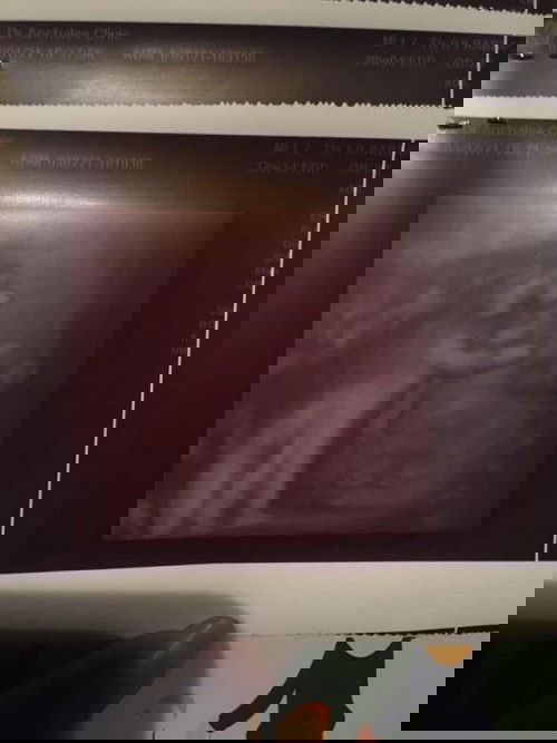 หนูเครียดอะไรลูกไม่ยอมให้เเม่เห็นหน้าเลย🥰👶🏻