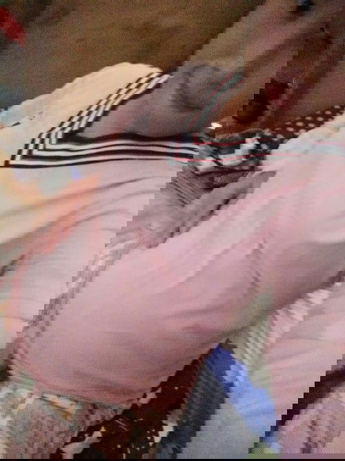 แม่ๆท้อง20วิคมีอาการตกขาวดหมือนบ้านนี้ไหม.