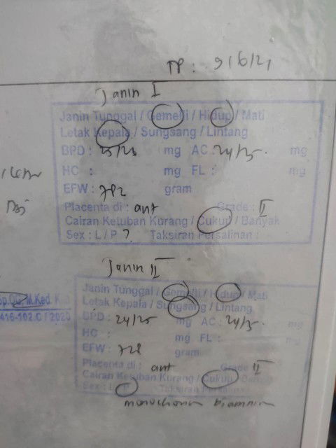 Bagi2 pengalaman hamil kembar