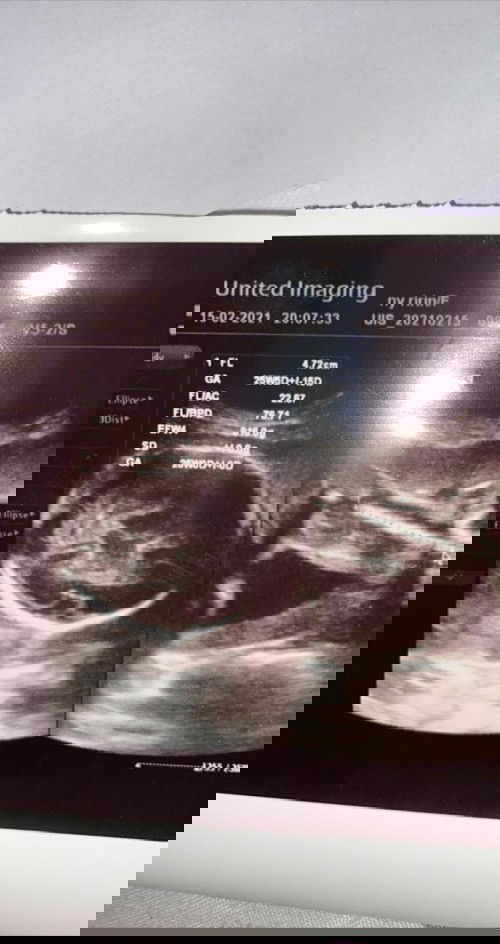 Mau tanya juga buat bunda2 disini, karena aku baru pertama kali hamil.. kira2 mulai kapan beli2 barang utk baby bun??