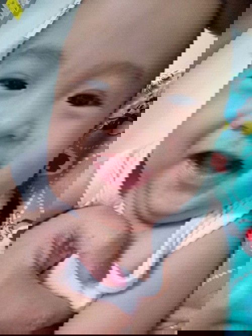 Red and Dry Rashes on face