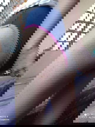 Mga mommy ano pwedeng cream para mawala mga peklat ko? Nakuha ko po to dahil sa pag bubuntis ko.