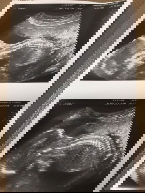 ผู้หญิง หรือ ผู้ชาย !!?