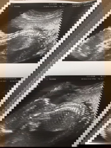 ผู้หญิง หรือ ผู้ชาย !!?