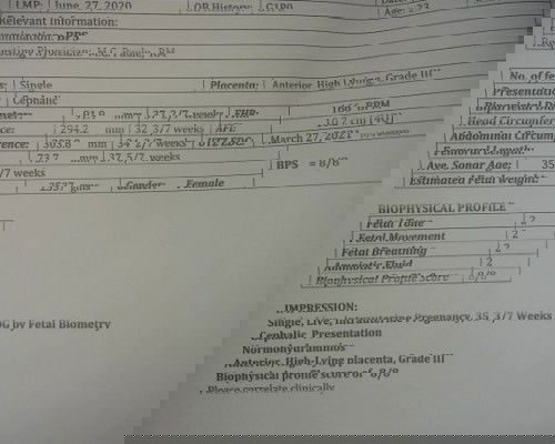 Normal lang po ba ultrasound ko.?