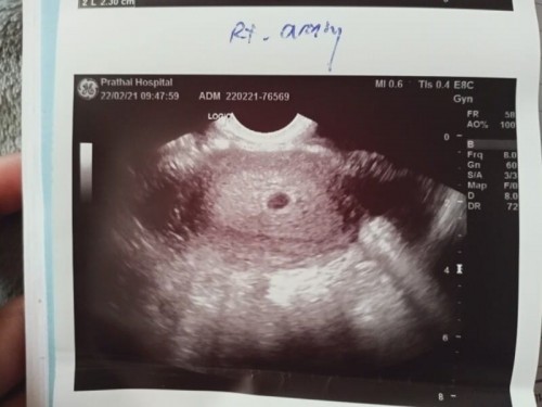 หนูกังวลใจมากๆเลยค่ะ ขอคำปรึกษาหน่อยค่ะ