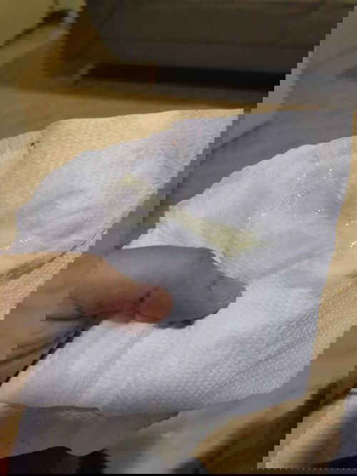 มูกแบบนี้3วันแล้ว​ 37w