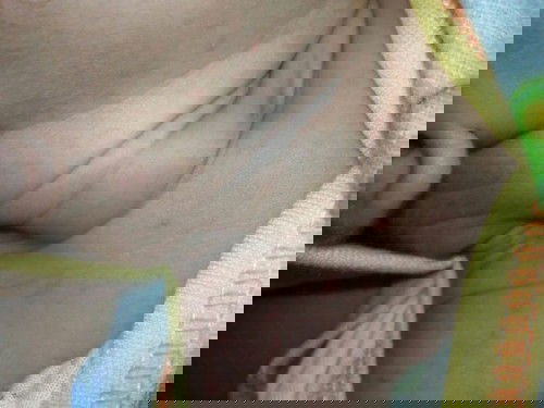 Apakah ini biang keringet .?