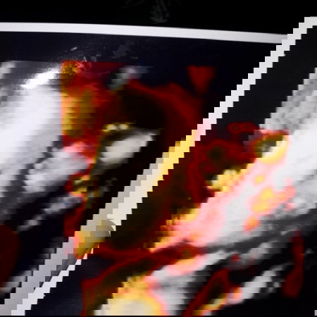 Hasil usg dan hpht berbeda