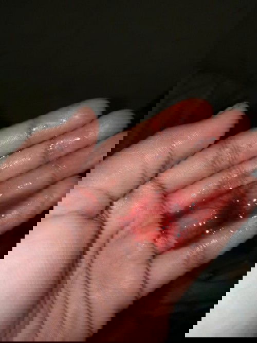 Lendir darah, maaf bunda jgn liat ini jorok.