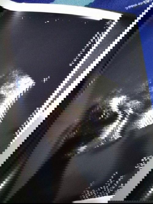 Hasil USG setelah lahiran normal