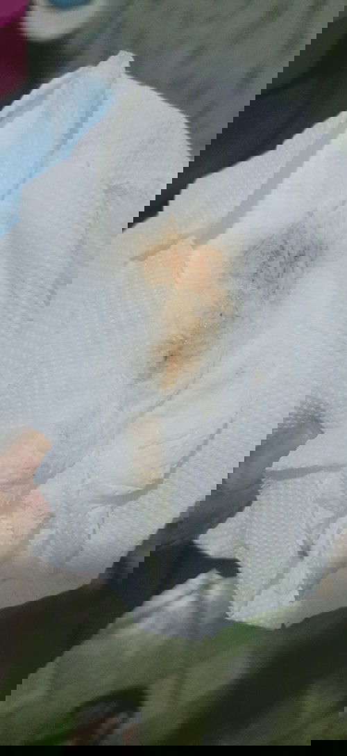 Pls mga kamomsh pray for me and my baby 15 weeks and 3 days po ako pang limang