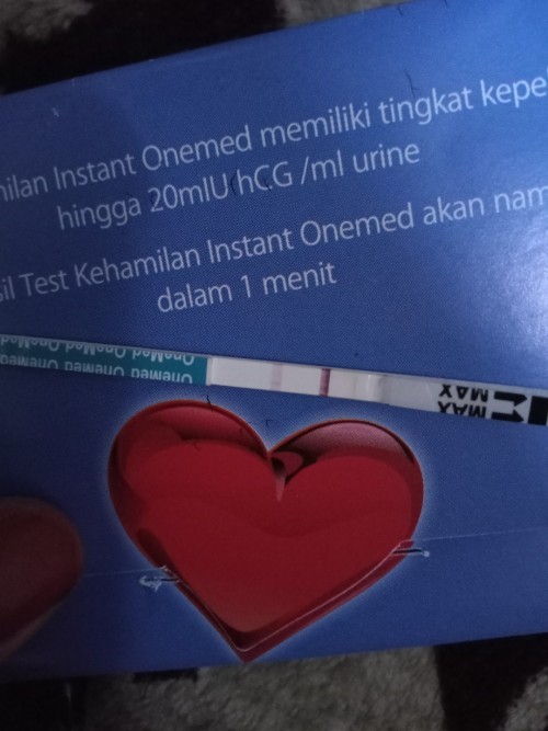 Garis yang terbalik