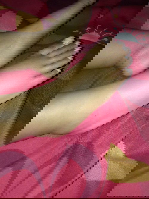 Kaki dede tiba2 bengkak